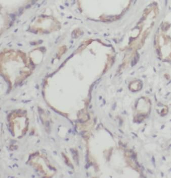 EIF2A Rabbit Polyclonal Antibody