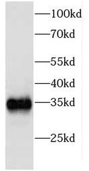 EIF2B1 Antibody