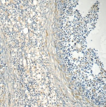 EIF2B2 Rabbit Polyclonal Antibody