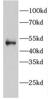 EIF2B3 Antibody