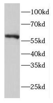 EIF2B4 Rabbit Polyclonal Antibody