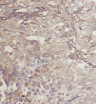 EIF2B4 Rabbit Polyclonal Antibody
