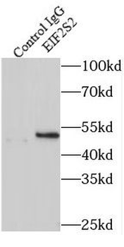 EIF2S2 Antibody