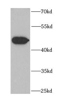 EIF2S3 Antibody