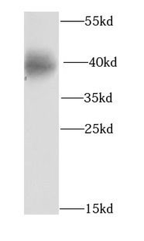 EIF3M Rabbit Polyclonal Antibody