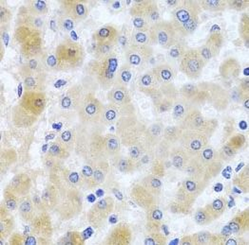 EIF3M Rabbit Polyclonal Antibody