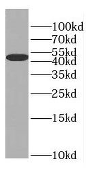 EIF4A3 Rabbit Polyclonal Antibody