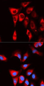 EIF4B Rabbit Polyclonal Antibody