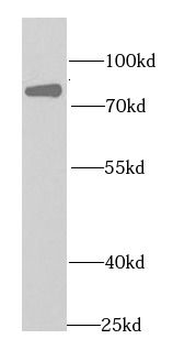 EIF4B Rabbit Polyclonal Antibody