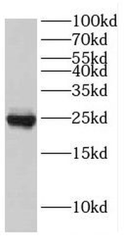 EIF4E3 Antibody