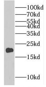 EIF4EBP2 Antibody