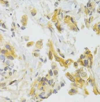 EIF4G1 Rabbit Polyclonal Antibody