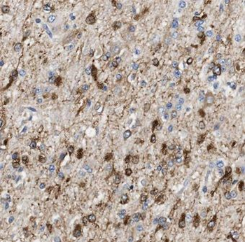 EIF5B Rabbit Polyclonal Antibody