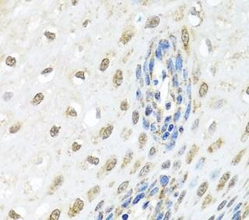 ELAC2 Rabbit Polyclonal Antibody