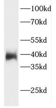 ELMOD1 Antibody