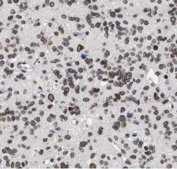 ELMOD1 Rabbit Polyclonal Antibody