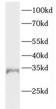 ELMOD2 Rabbit Polyclonal Antibody