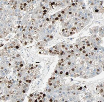 ELMOD2 Rabbit Polyclonal Antibody