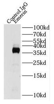 EMD Antibody