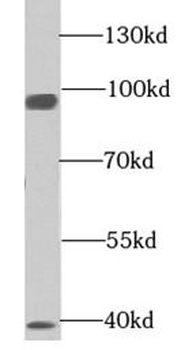 EML1 Rabbit Polyclonal Antibody