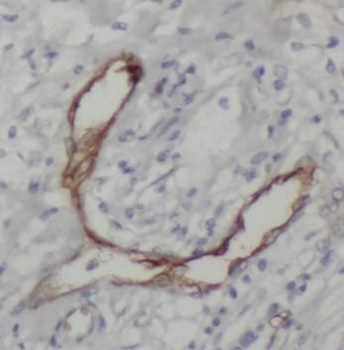 ENG Rabbit Polyclonal Antibody
