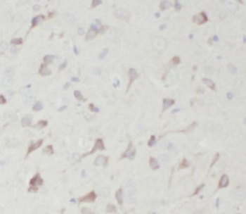 ENO1 Rabbit Polyclonal Antibody