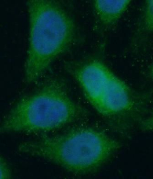 ENO1 Rabbit Polyclonal Antibody