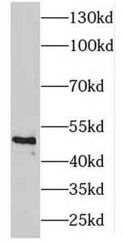 ENO3 Rabbit Polyclonal Antibody