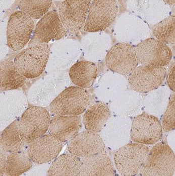 ENO3 Rabbit Polyclonal Antibody