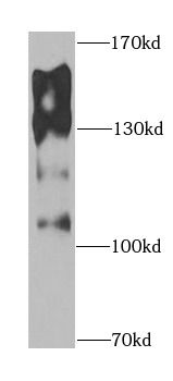 ENPEP Antibody
