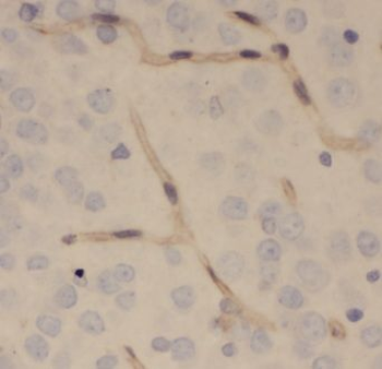 ENPP4 Rabbit Polyclonal Antibody