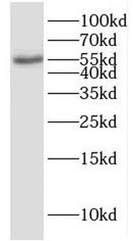 ENPP5 Antibody