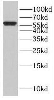 ENTPD3 Antibody