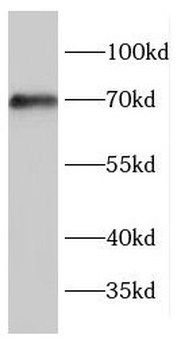 ENTPD7 Antibody