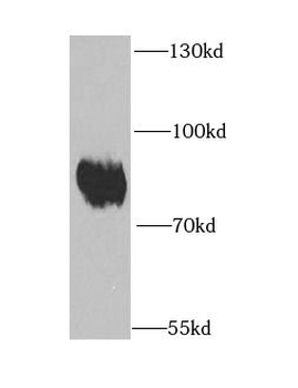 EPB41 Antibody