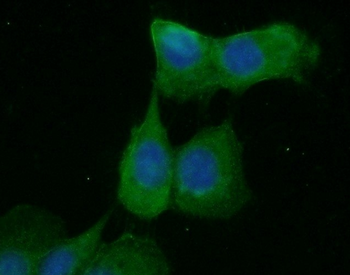 EPCAM Rabbit Polyclonal Antibody