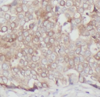 EPCAM Rabbit Polyclonal Antibody