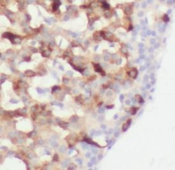 EPHB4 Rabbit Polyclonal Antibody