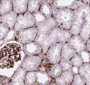 EPSTI1 Rabbit Polyclonal Antibody