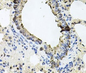 ERBB4 Rabbit Polyclonal Antibody