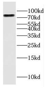 ERCC2 Rabbit Polyclonal Antibody