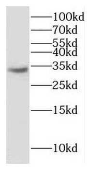 ERGIC1 Rabbit Polyclonal Antibody