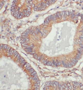 ERGIC1 Rabbit Polyclonal Antibody