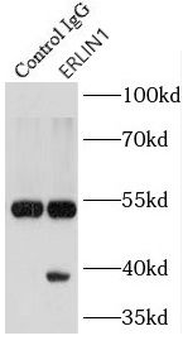 ERLIN1 Antibody