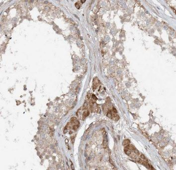 ERLIN1 Rabbit Polyclonal Antibody