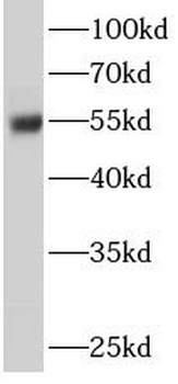 ERO1B Rabbit Polyclonal Antibody