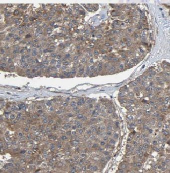 ERO1B Rabbit Polyclonal Antibody
