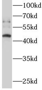 ERO1B Rabbit Polyclonal Antibody