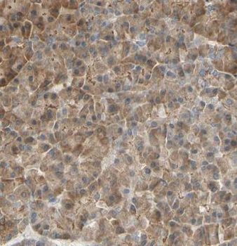 ERO1B Rabbit Polyclonal Antibody
