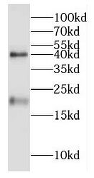 TXNDC12 Rabbit Polyclonal Antibody